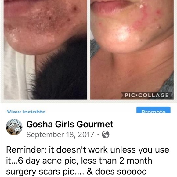 ❤️‍🩹🛍Miracle Healing Balm SET ❤️‍🩹CRAZY FRI PM DEAL!! - Picture 4 of 8